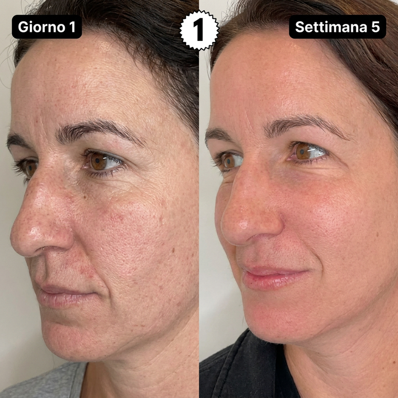 Eczema e Irritazione